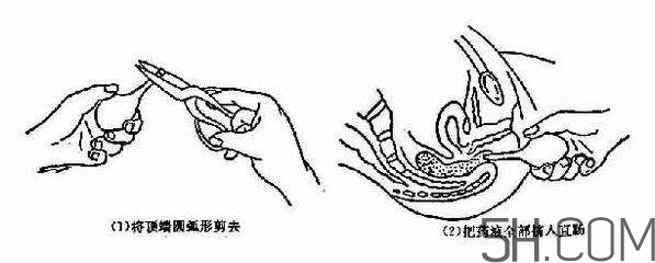 開(kāi)塞露怎么用？開(kāi)塞露用后多久會(huì)排便？