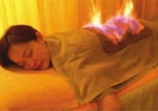 火療能治婦科病嗎？火療能去濕氣嗎