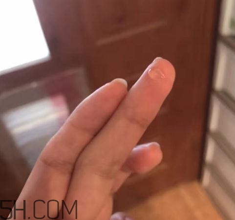 倍舒痕可以去痘印嗎？倍舒痕能涂在痘痘上嗎？
