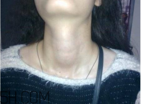 甲狀腺結(jié)節(jié)掛什么科？甲狀腺結(jié)節(jié)可以懷孕嗎