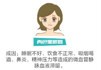 黑眼圈怎么去除既簡單有容易 看類型與程度