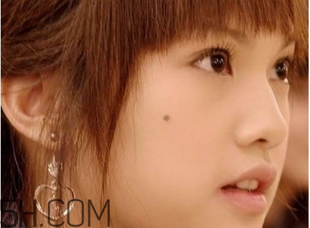 痣是怎么形成的？女人痣長哪里最有福氣