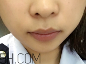 小蜜蜂細致修護唇膏很油嗎？夏天用合適嗎？