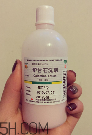 爐甘石洗劑多少錢一瓶？爐甘石洗劑治痤瘡嗎？
