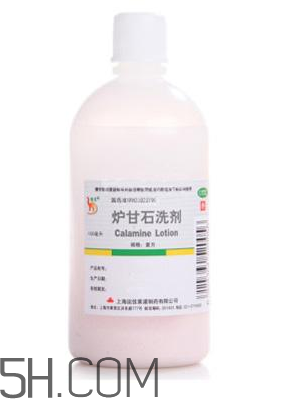 爐甘石洗劑是激素藥嗎？爐甘石洗劑是處方藥嗎？