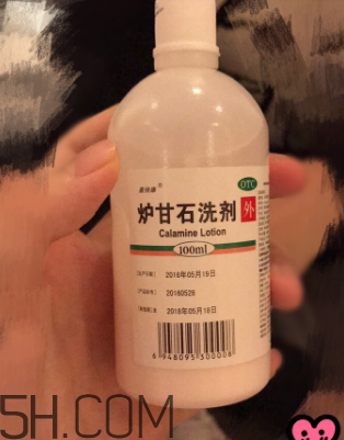 爐甘石洗劑是洗還是擦？爐甘石洗劑是什么顏色？