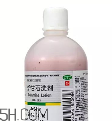 爐甘石洗劑是洗還是擦？爐甘石洗劑是什么顏色？