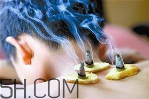 艾灸對慢性咽炎有用嗎？慢性咽炎可以通過艾灸來治療嗎？