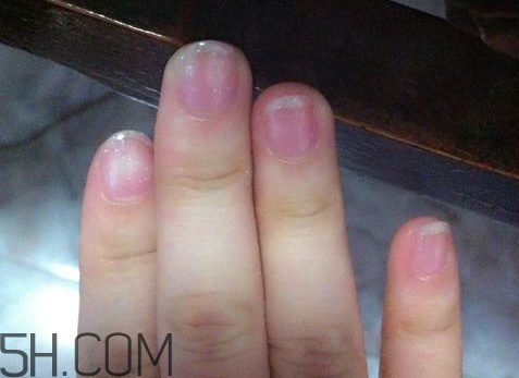 美甲后指甲受損怎么辦？指甲破損怎么修復(fù)？