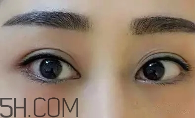 紋美瞳線是永久的嗎？紋美瞳線的注意事項