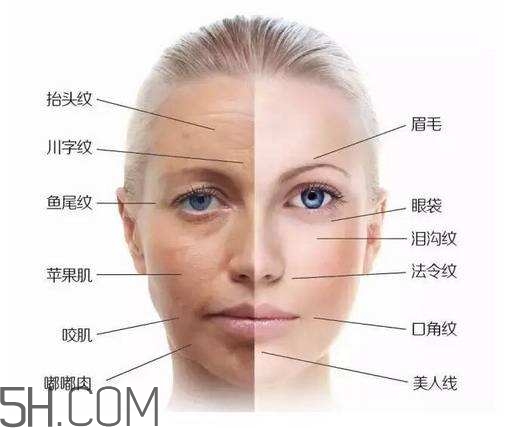 怎么預防皺紋的產(chǎn)生？導致皺紋的產(chǎn)生的原因有哪些？