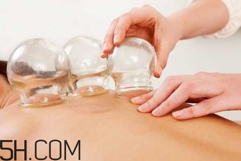 拔罐可以治療鼻炎嗎？鼻炎拔罐拔哪里？