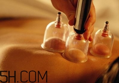 拔罐可以治療鼻炎嗎？鼻炎拔罐拔哪里？