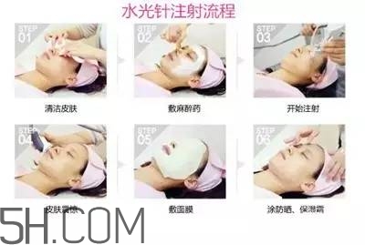 打水光針多久打一次？水光針的誤區(qū)