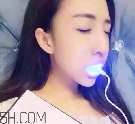 美牙儀可以兩個人用嗎？美牙儀用多久才有作用？