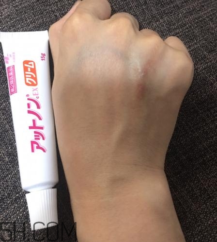 小林制藥祛疤膏有效嗎？小林制藥祛疤膏怎么樣？