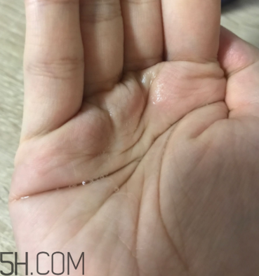 雪肌精卸妝油糊眼睛嗎？雪肌精卸妝油悶痘嗎？