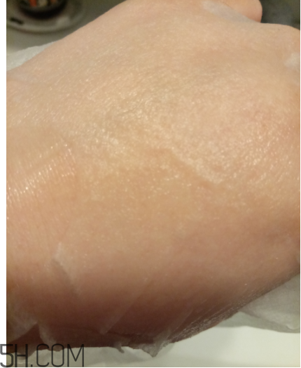 WIS痘肌修護(hù)面膜有效嗎？適合敏感肌嗎？