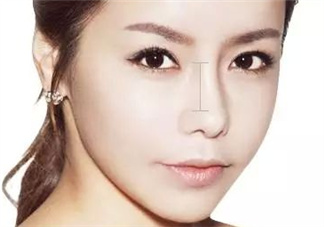 達(dá)拉斯隆鼻是什么材料？達(dá)拉斯隆鼻怎么樣？