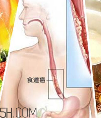 吃太燙會得癌？燙食不僅對胃不好還容易得癌