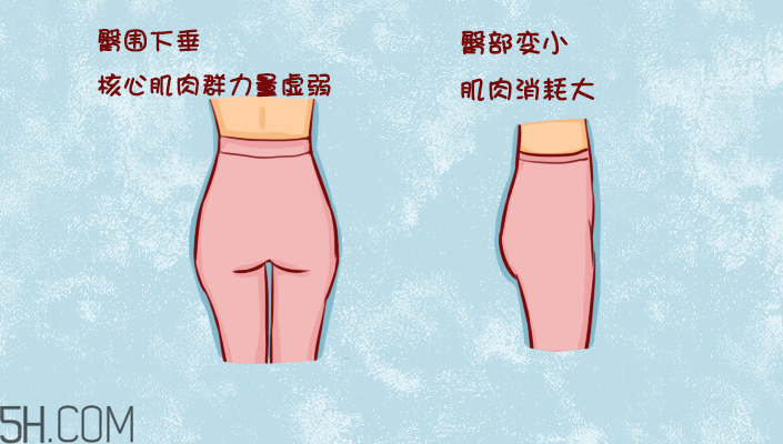臀部護(hù)理對(duì)健康有什么影響？日常如何保養(yǎng)臀部健康？