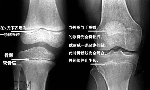 孩子學(xué)街舞好不好？學(xué)街舞好處多多