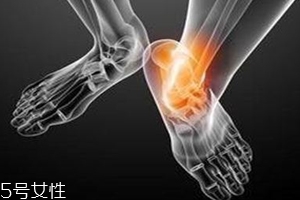 痛風(fēng)跟飲食有關(guān)？痛風(fēng)更多與遺傳有關(guān)