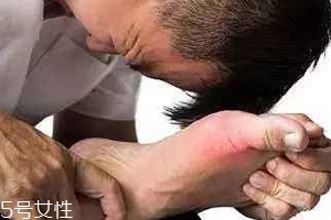 痛風(fēng)可以治愈嗎？無(wú)法治愈但能控制