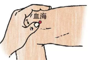 濕疹怎么治才管用？?jī)?nèi)外同治是關(guān)鍵