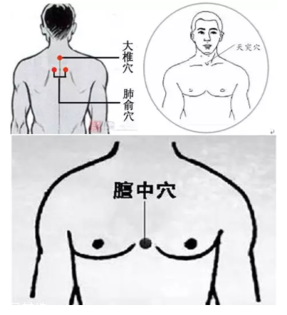 吮痧有什么療效？最溫柔的治病方法