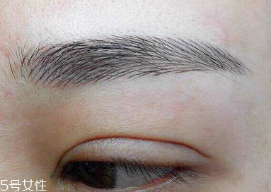 激光洗眉恢復(fù)期有疤痕怎么辦？激光洗眉毛之后正確護(hù)理方法