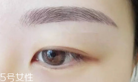 激光洗眉恢復(fù)期有疤痕怎么辦？激光洗眉毛之后正確護(hù)理方法