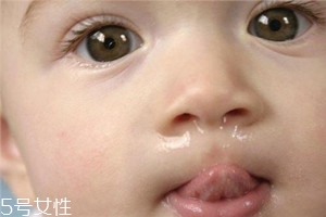 冬季寶寶流鼻涕是什么原因？教你幾招輕松應(yīng)對(duì)
