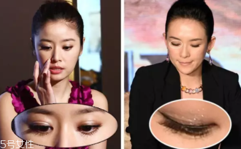 內(nèi)雙怎么進(jìn)化成雙眼皮？全是雙眼皮貼的功勞