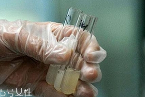 捐精有什么危害？專家稱沒有危害