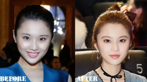 瑯琊榜2張慧雯整容了嗎？換了妝發(fā)美到不認(rèn)識