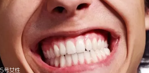 磨牙是因為受了委屈？孩子的心理狀況也會導致磨牙
