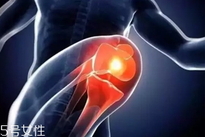 關節(jié)有響聲是病嗎？兩種情況區(qū)別對待
