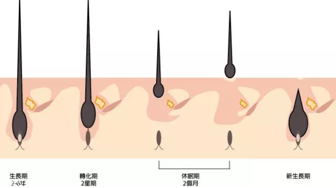 頭發(fā)為什么會(huì)掉？毛囊想休息了