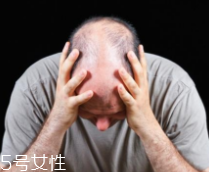 脫發(fā)有沒有治？只要不是禿子就有得治