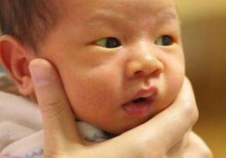 新生兒長黃疸怎么辦？有些黃疸癥狀媽媽們可別忽視