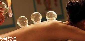 拔火罐引火上身的原因是什么？這4點(diǎn)要注意