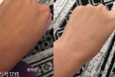 美白精華只能晚上用嗎？白天要做好防曬
