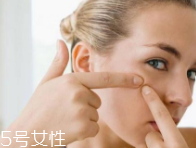 肌膚需要排毒嗎？長痘并不代表排毒