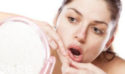 肌膚需要排毒嗎？長痘并不代表排毒