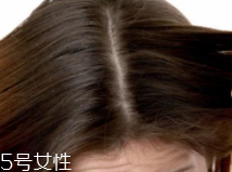 油性頭發(fā)跟什么有關(guān)？離不了這6個原因