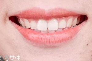 口紅病有哪些癥狀？使用不當(dāng)引發(fā)癌癥