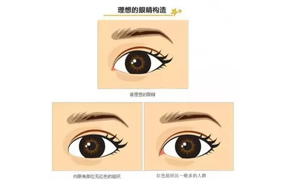 開(kāi)外眼角和開(kāi)內(nèi)眼角哪個(gè)好？開(kāi)眼角有可能會(huì)回縮