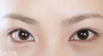割雙眼皮的術(shù)前準(zhǔn)備有哪些？割雙眼皮的常見做法