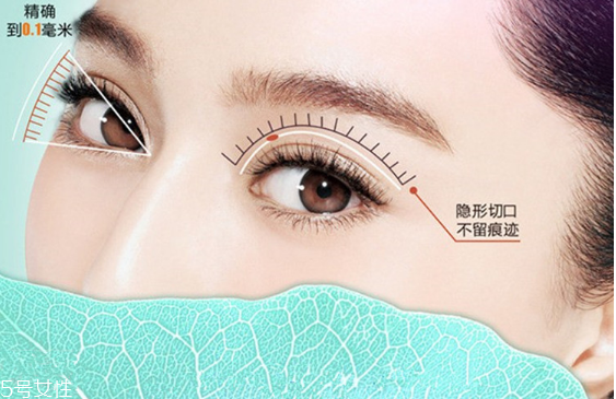 韓式雙眼皮是永久的嗎？圓眼睛不適合做雙眼皮